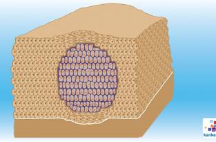 Goedaardige tumor.jpg